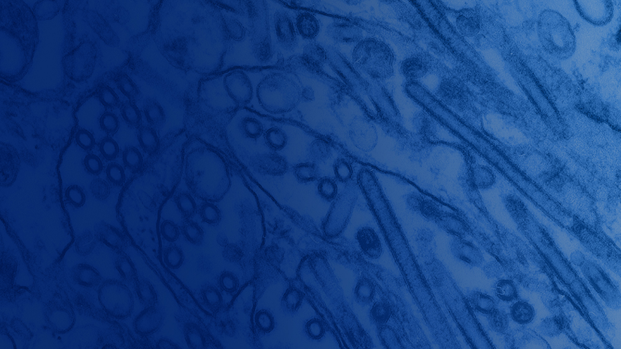 digitally-colorized transmission electron microscopic (TEM) image of Avian Influenza A H5N1 viruses grown in epithelial cells. Photo by CDC on Unsplash.