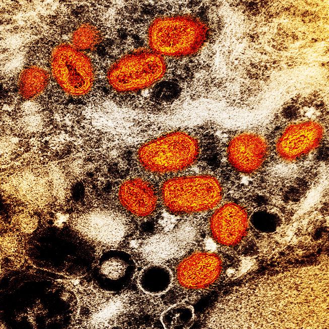 mpox brown orange