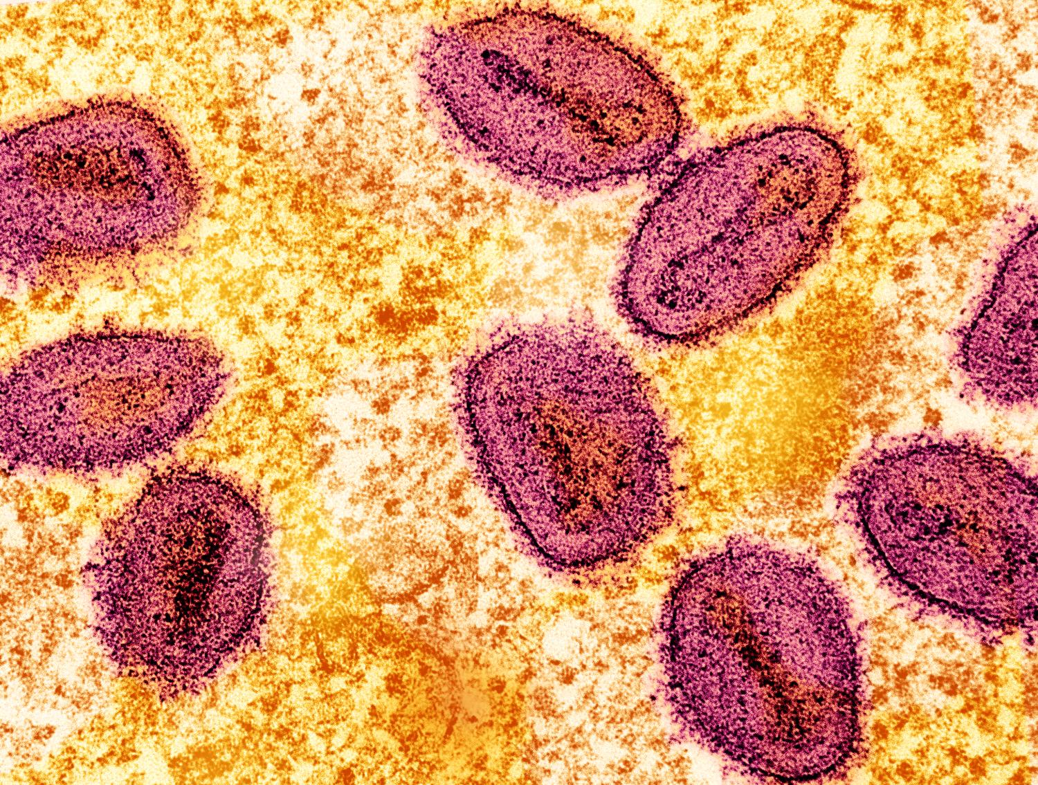 mpox virus 