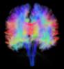 Color MRI brain image