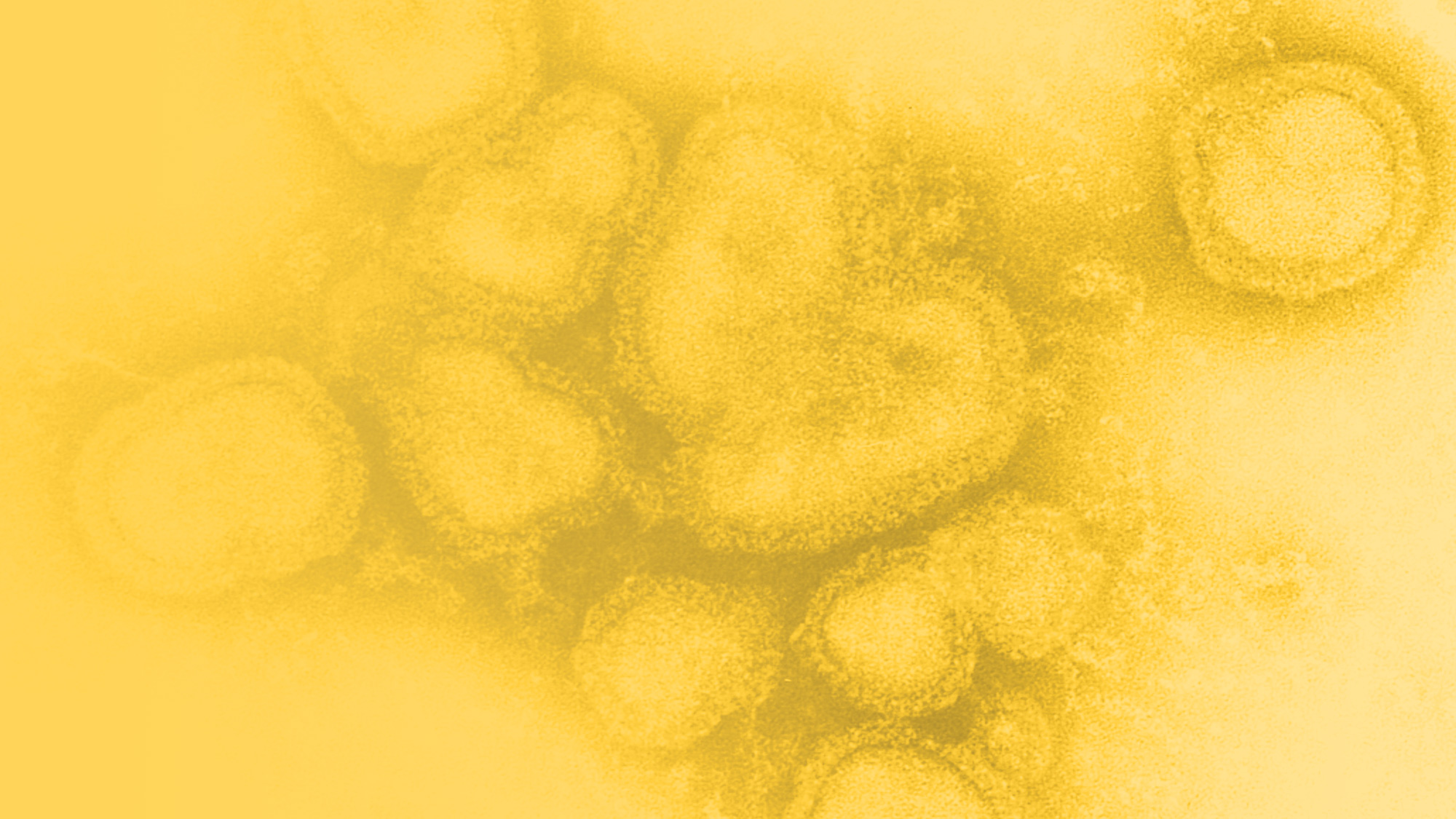 Influenza A virions - Yellow