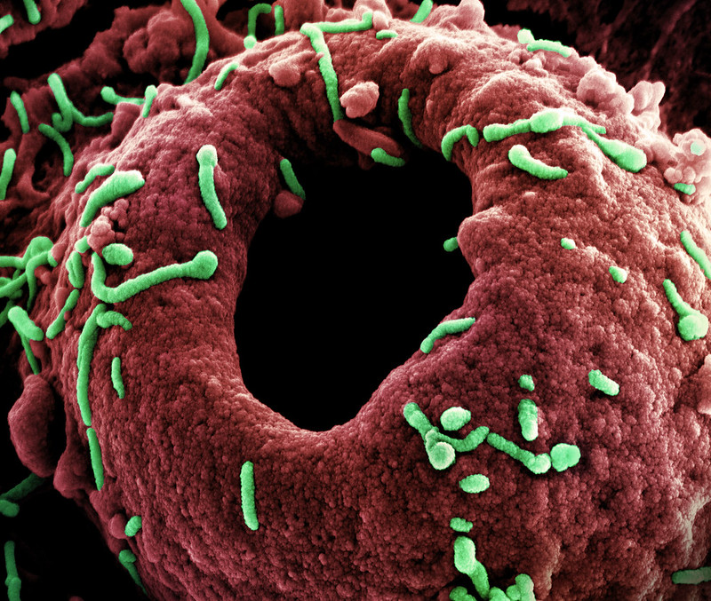 marburg virus