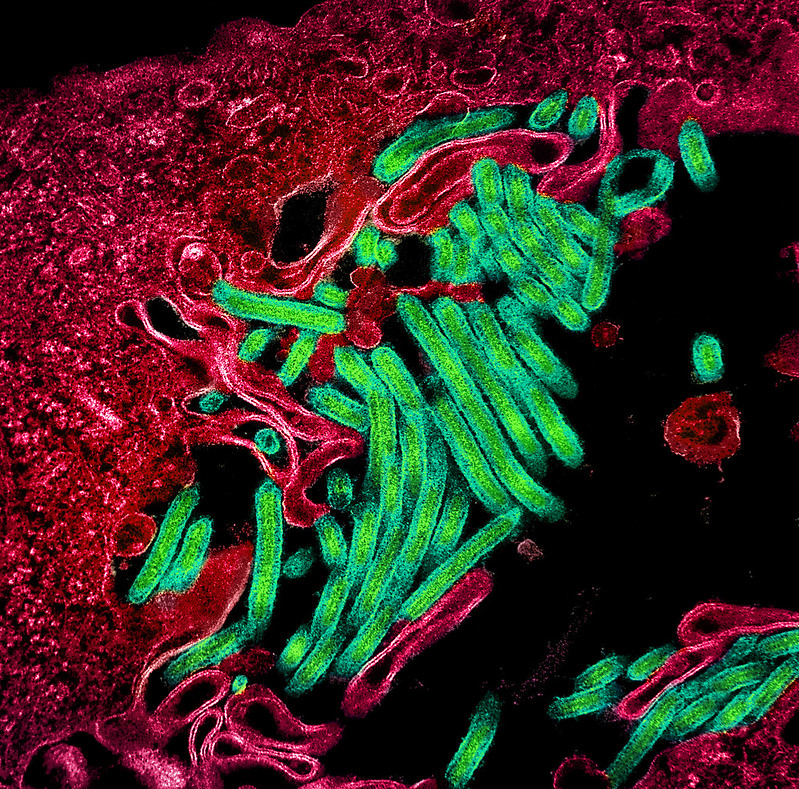 Ebola virus