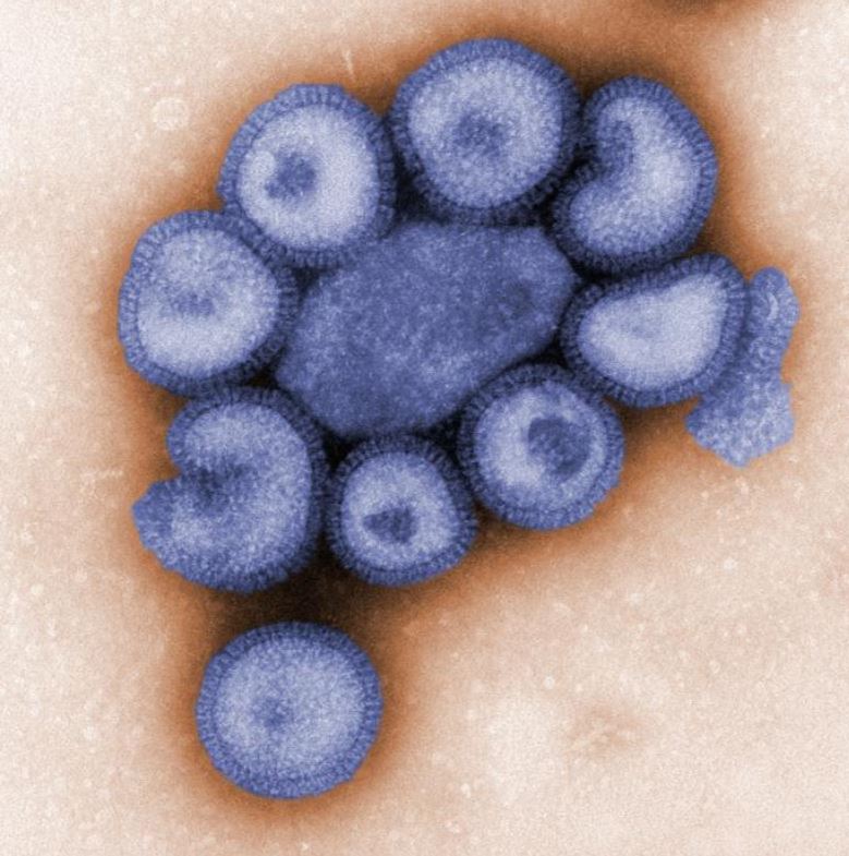Influenza viruses under microscope