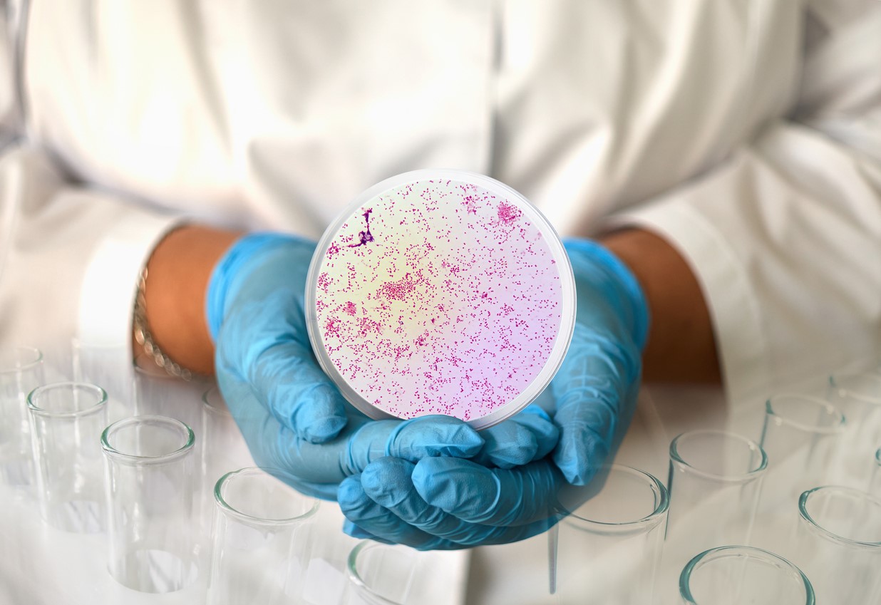 Gonorrhea bacteria in petri dish
