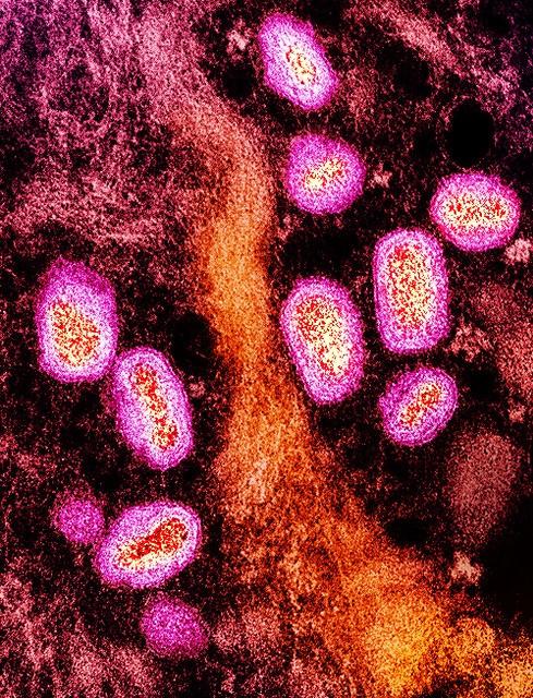 pink mpox micrograph