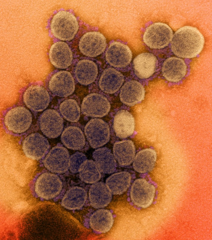 SARS-CoV-2 viruses