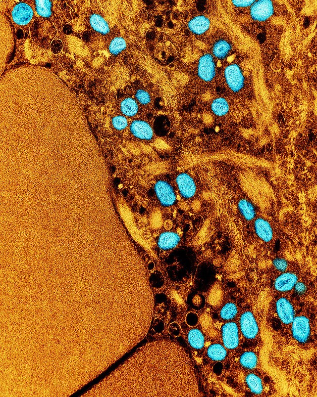 mpox viruses under microscope