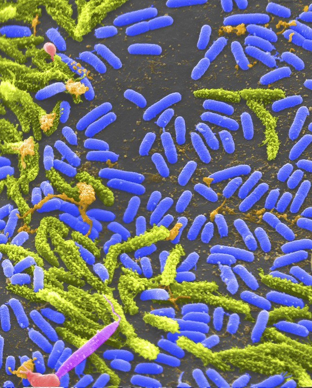 Vibrio bacteria