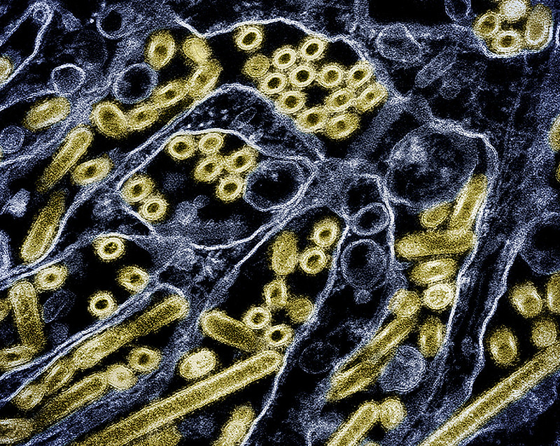 H5N1 particles