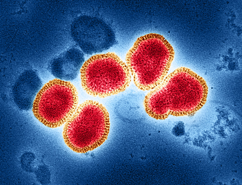 flu virus NIAID