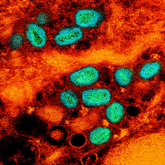 mpox aqua orange