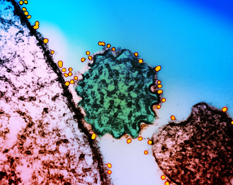 Nipah virus particles