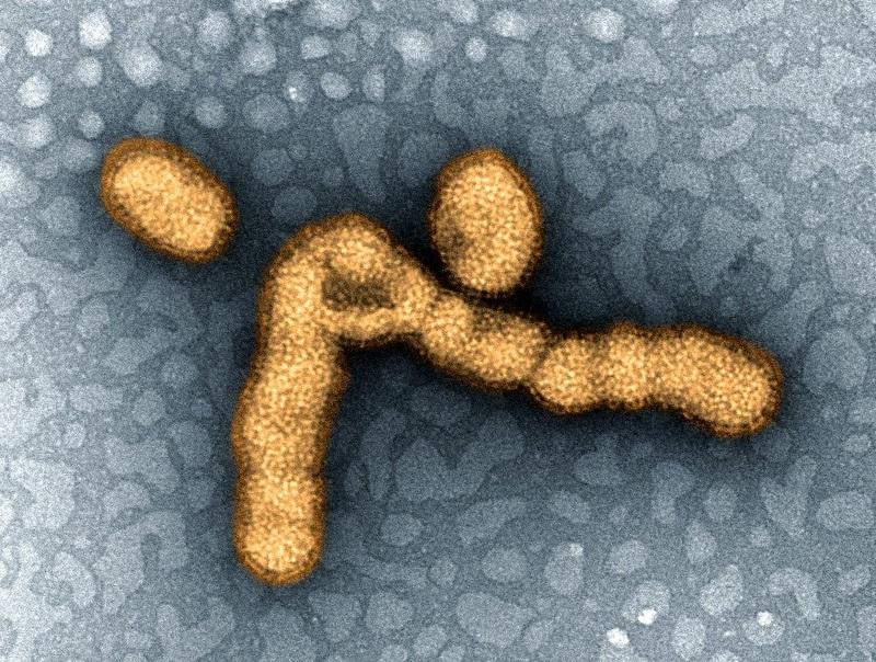 Influenza virus, highly magnified