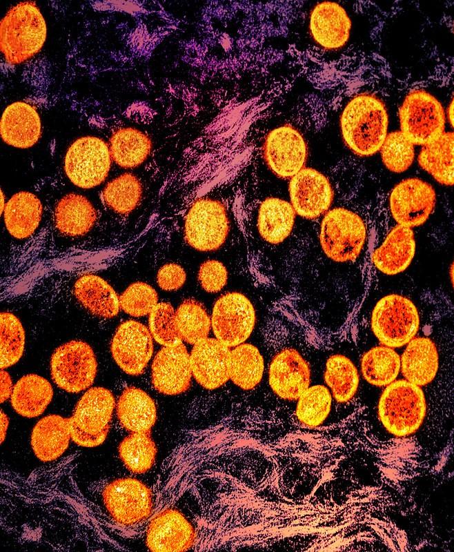 Micrograph of mpox viruses