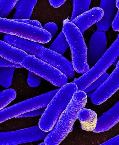 E coli bacteria up close