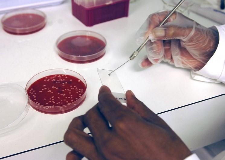 Scientist performing Gram staining in lab