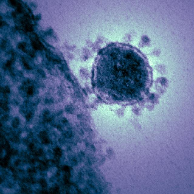 Electron micrograph of MERS-CoV