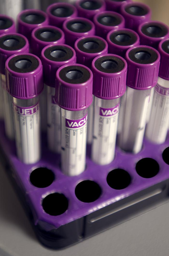 Vacutainer blood testing tubes