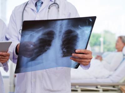 Examining a chest x-ray