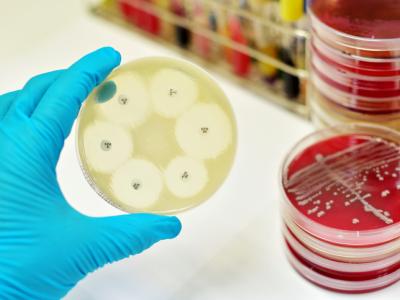 Antibiotic susceptibility test