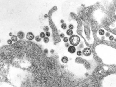 Lassa fever virus micrograph