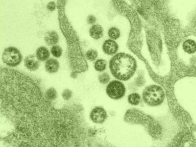 Lassa fever virus