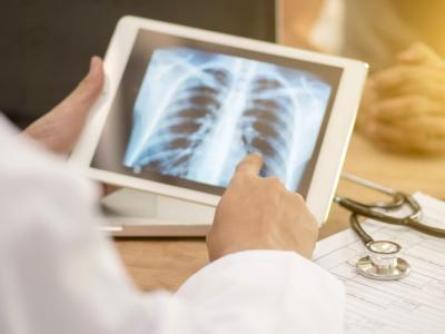 Lung x-ray on tablet