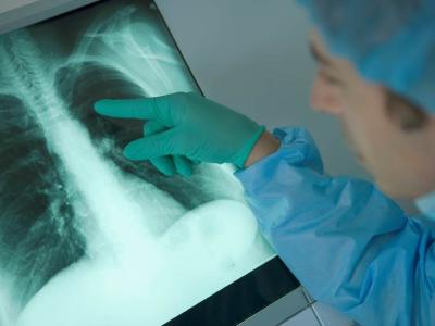 Clinician examining lung film