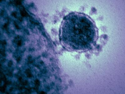 Electron micrograph of MERS-CoV