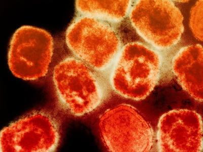 monkeypox viruses highly magnified