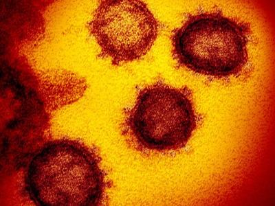 SARS-CoV-2, the virus that causes COVID-19