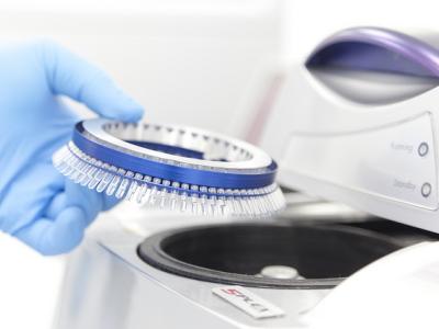 Rotor-Gene Q PCR test