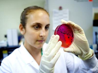 Salmonella culture in Petri dish