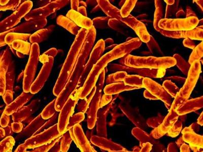 Mycobacterium tuberculosis bacteria