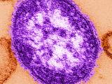 measles image