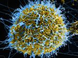 Ebola blue gold