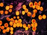 mpox purple orange