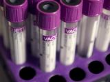 Vacutainer blood testing tubes