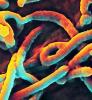 Ebola virus under the microscope