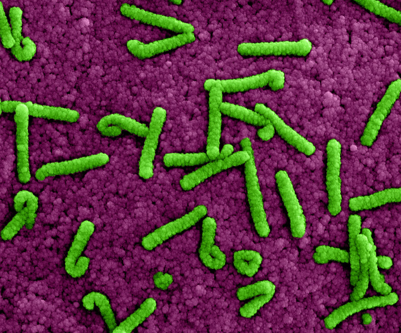 Marburg virus